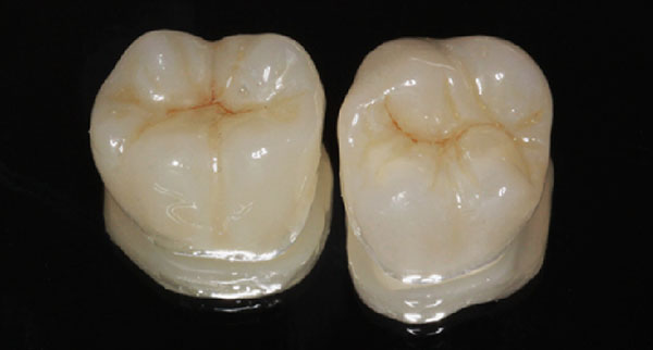 Treatment of caries in Prahue